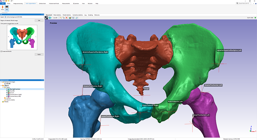 ortho extract software